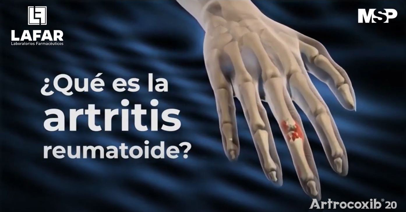 ARTOCOXIB 20 – Antirreumático